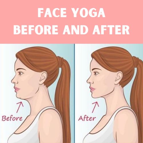 Face yoga before and after